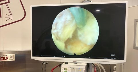 Cirugia-endoscopica2